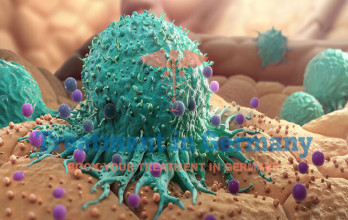 Cancer Causes and Prevention