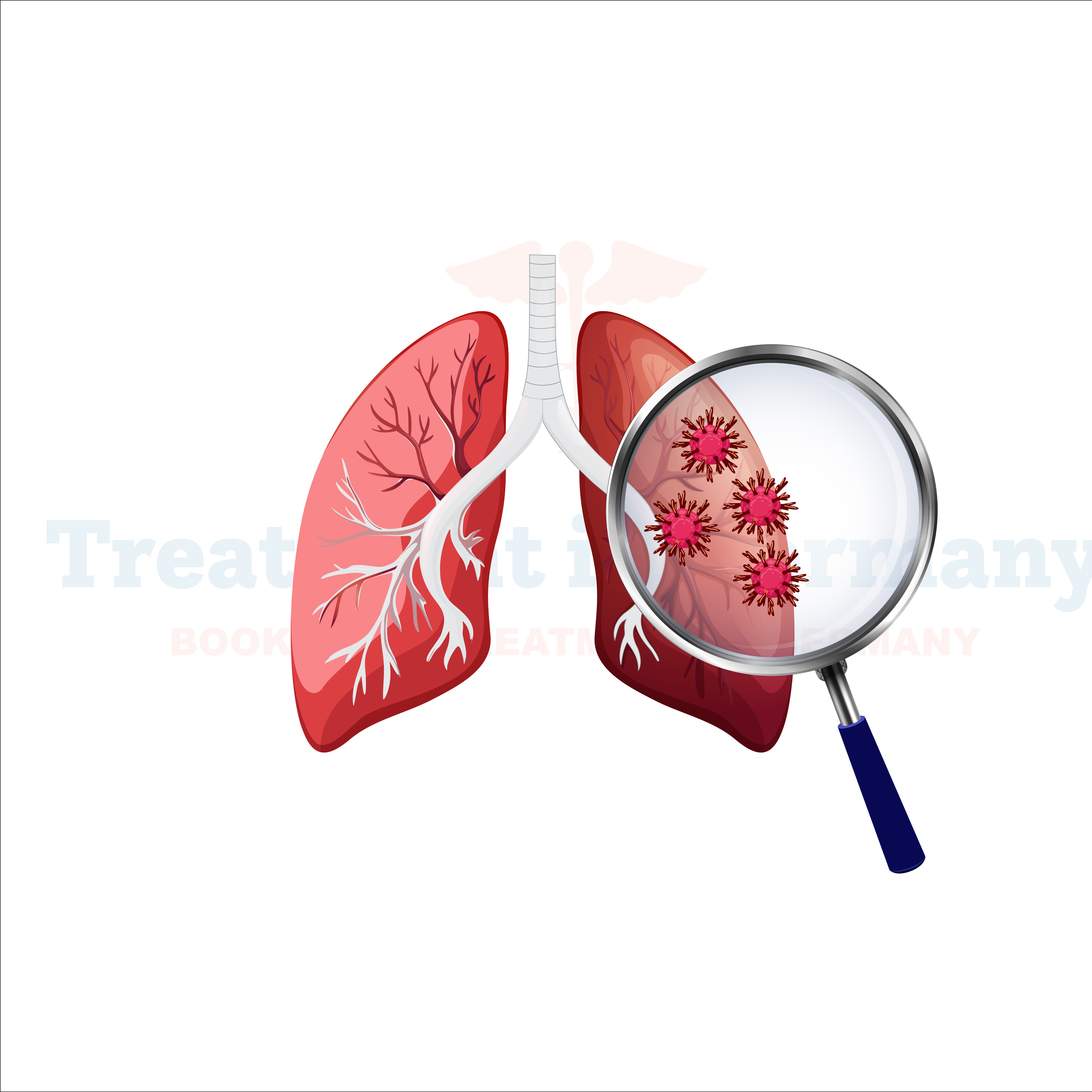 Lung Cancer