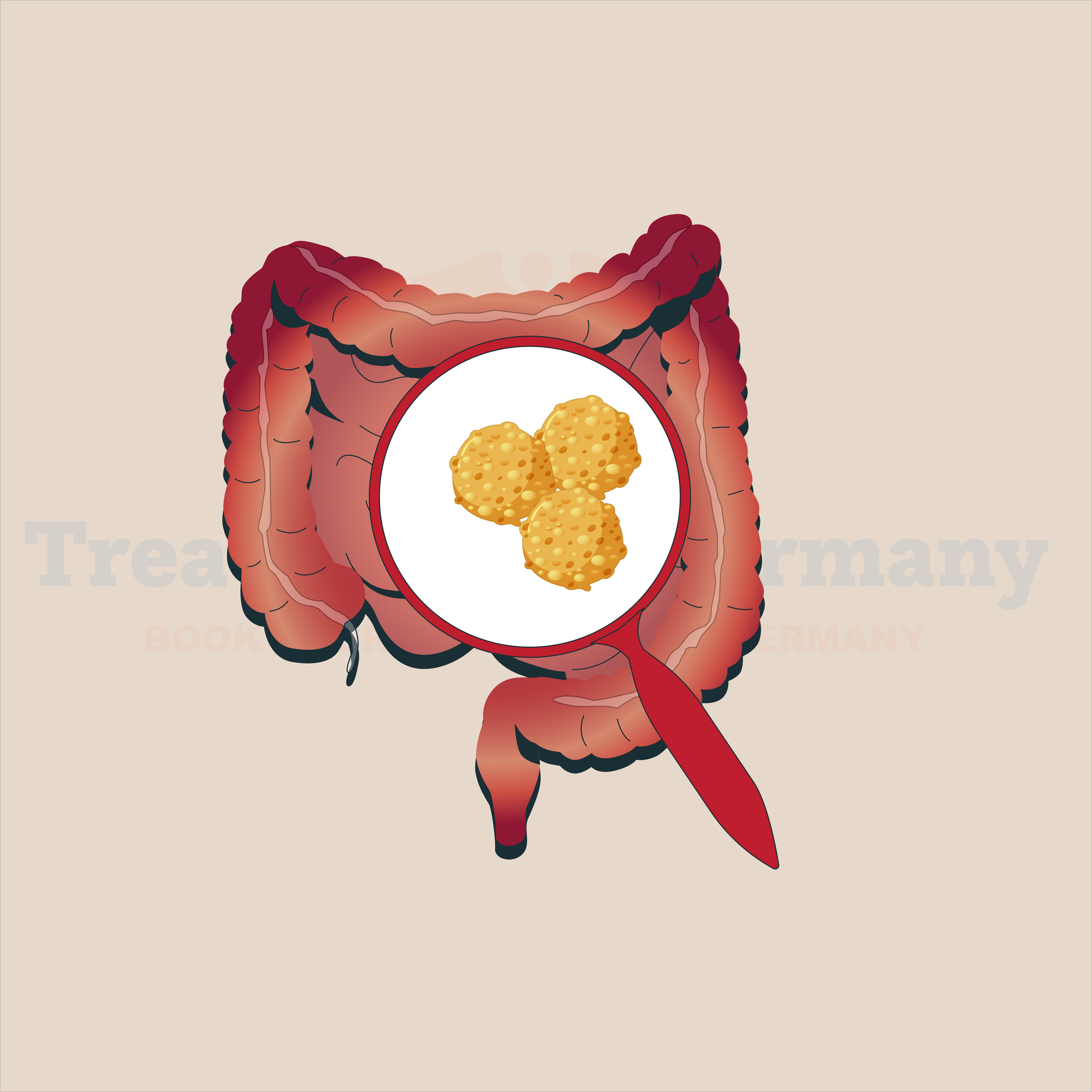 Small Intestine Cancer