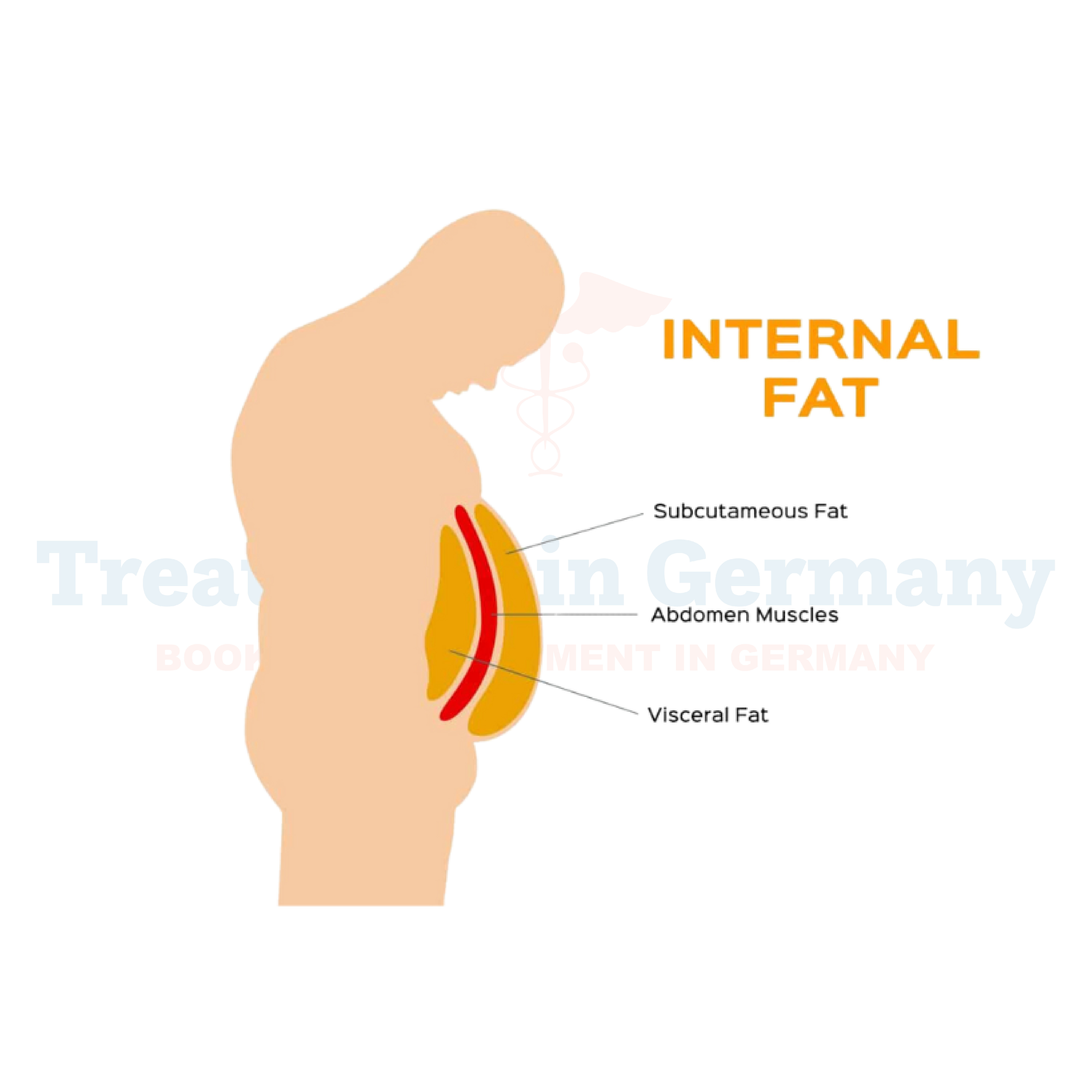 Abdominal Obesity