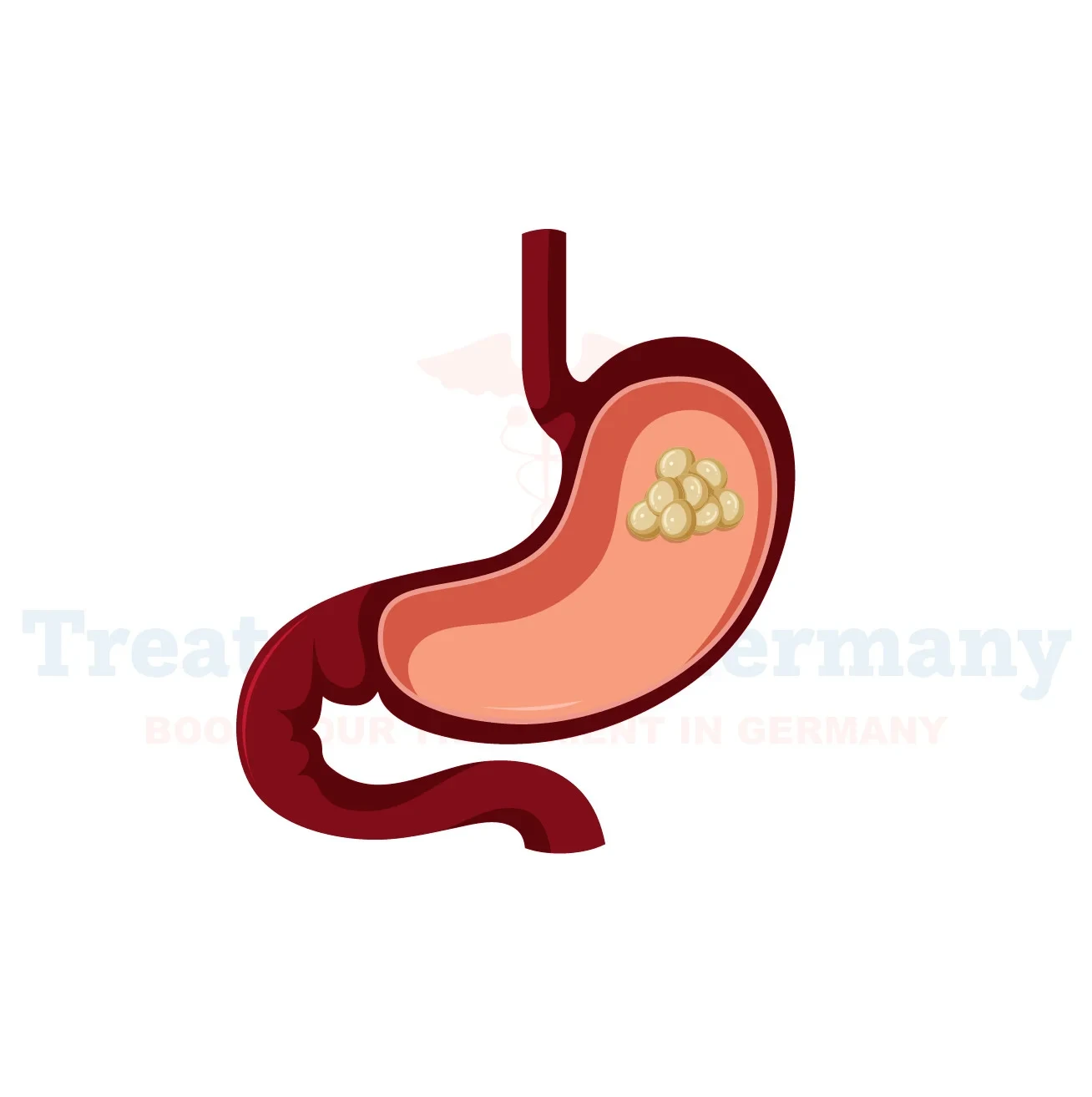 Esophageal Cancer
